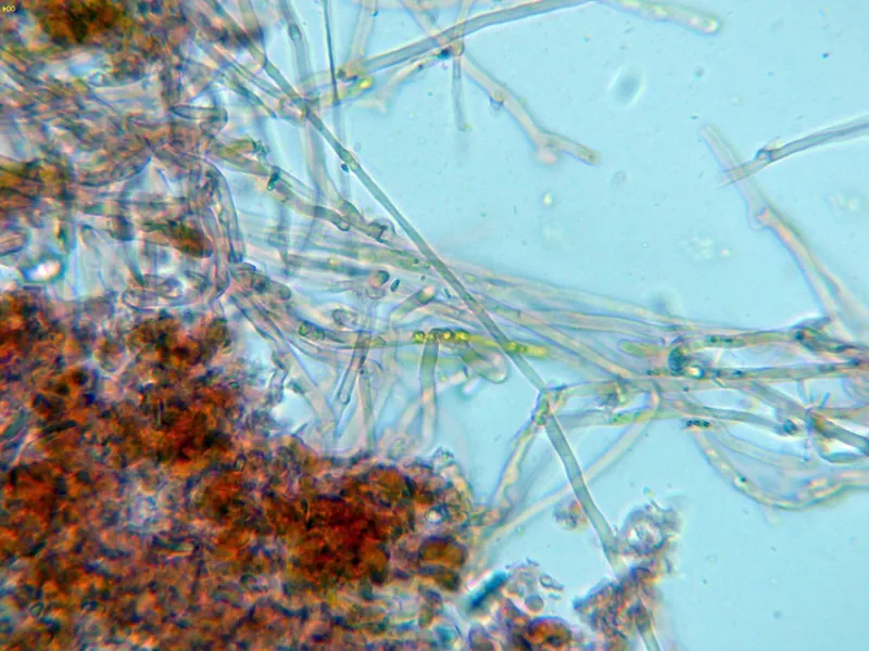 Athelia bombacina 10 - Hifas subiculares-004